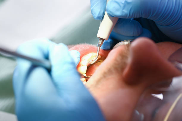 Best Emergency Pediatric Dental Care in North Liberty, IN